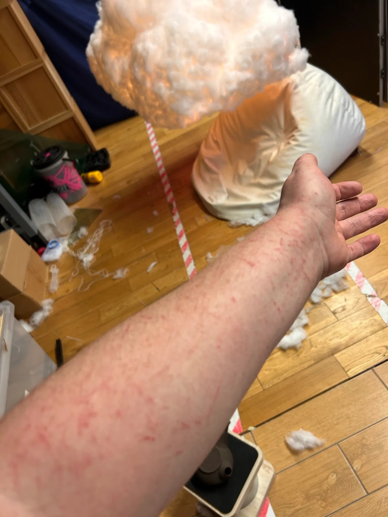 A forearm covered in scratches from the plastic mesh.